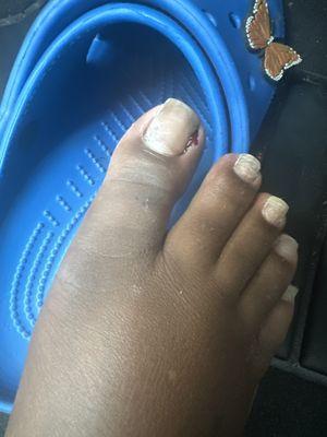 Cut cuticle from the lady. They offered no bandaid no nothing.
