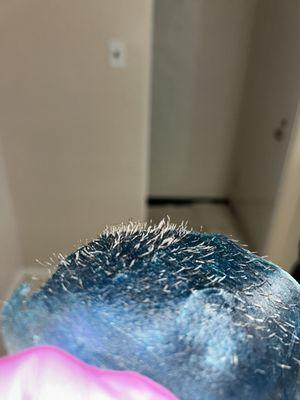 Deep follicles for daysssss