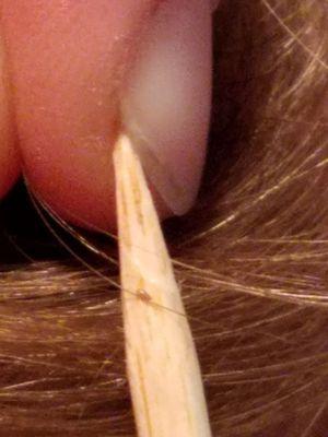 This Nit is so small!  The dark color shows it is Live too!