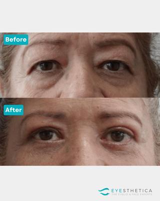 Jordan Conger, MD - Eyesthetica Pasadena