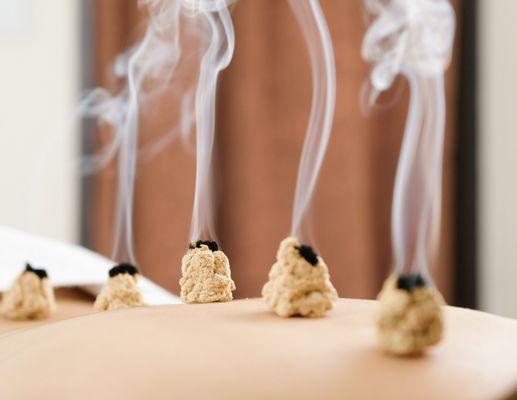 Moxibustion in Boston at North End Acupuncture