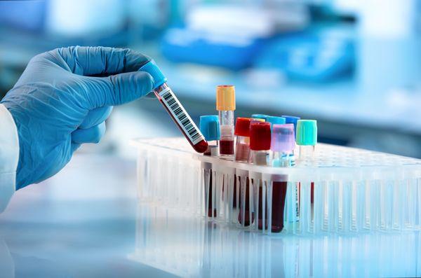 Phlebotomist On-Demand Services