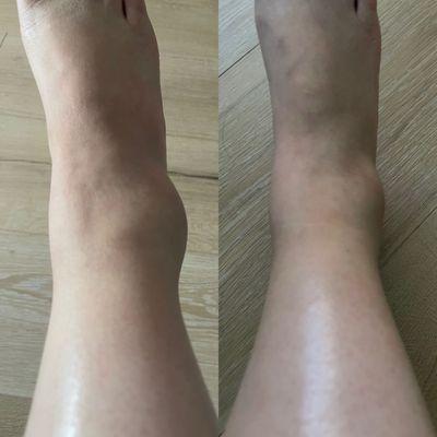 Treasure De La Cruz, LAC CMT