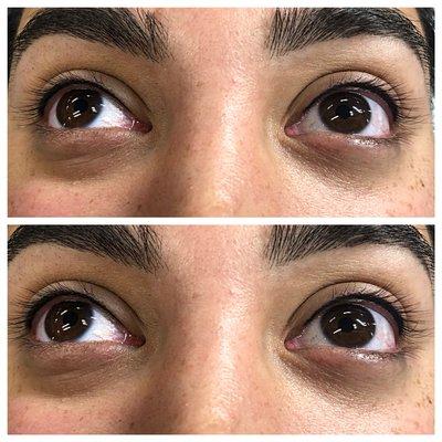 Eyelash enhancement