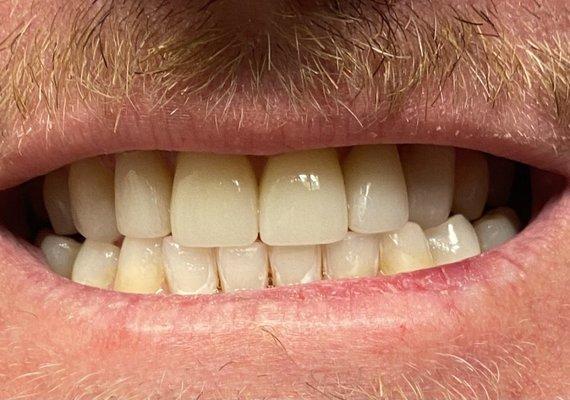 Cosmetic Dentistry Tustin Dental Exams - Jones D.D.S.