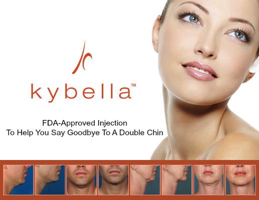 Kybella treats the double chin and is permanent