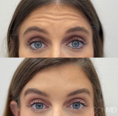 Icon MD Medical Spa + Laser Center