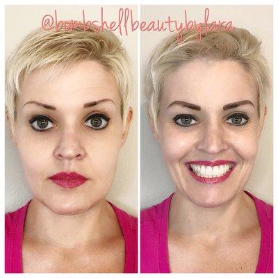 Corrective microblading