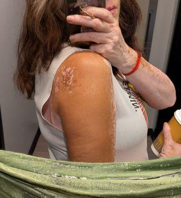 UCSD Dermatology Clinical