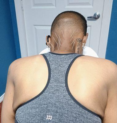 Alcocer Acupuncture Medical Clinic