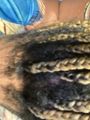 These were the braids I got taken down ...