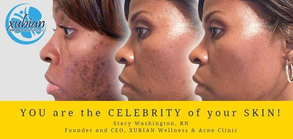 Xubian Wellness & Acne Clinic
