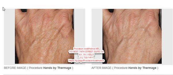 Precision Aesthetics MD