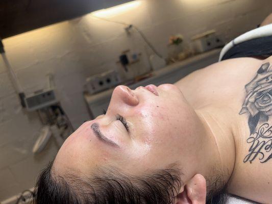 Dermaplane facial.