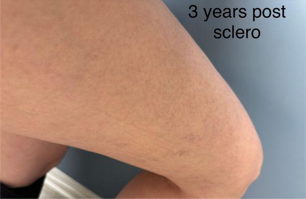 Fitzgibbons Vein Center