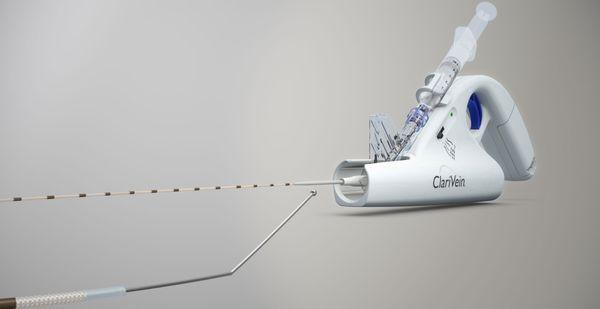 Clarivein, a new state of the art vein care treatment.