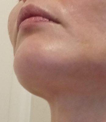 Pearlman D. Hicks Jr., M.D.