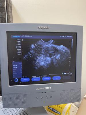 I'm not sure where my IUD is but apparently it's there. Dr. Feng didn't take the time to point it out to me.