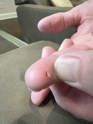 Finger cut from the zipper on the Paloma tote