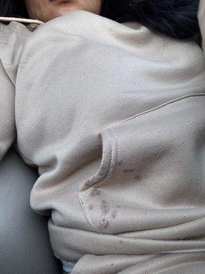 BioLife Plasma Services