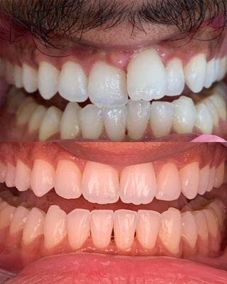 Emergency Dentist in Houston