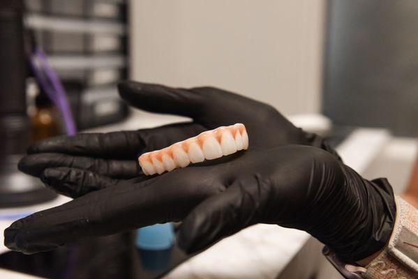 Smile Now Reno Dentures & Implants