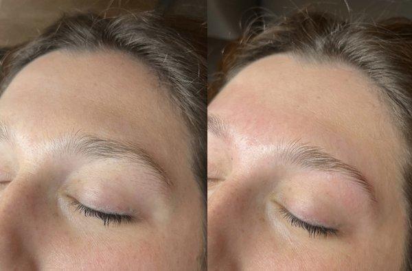 Sugar and Skin Aesthetics