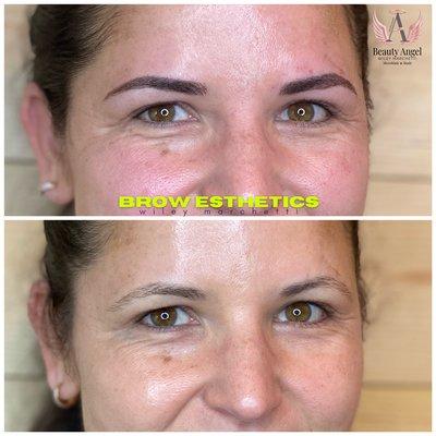 See how much her eyes got lifted after a shape tweak on  her eyebrows.