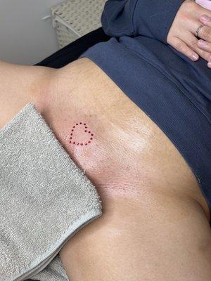 Vajazzle+ Brazilian