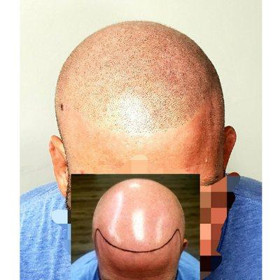 New Level Aesthetics