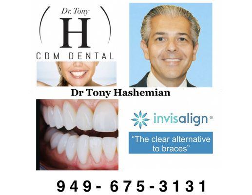 Invisalign " The clear alternative to braces "