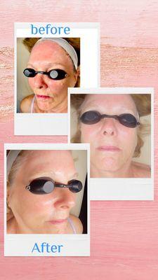 Love Your Mirror and Head spa