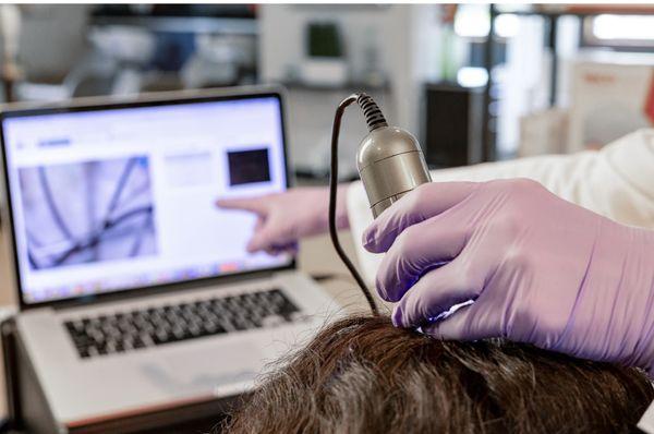 TricoTest Scalp Analysis