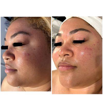 Hi Gorgeous Skin Care