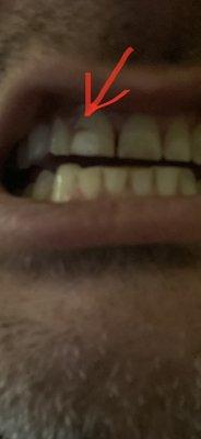 Wilson Avenue Dental