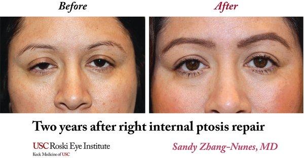 USC Roski Eye Institute- Oculo-Facial Plastic Surgery Service
