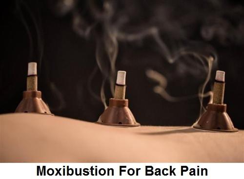 Moxisbustion for Any Pain