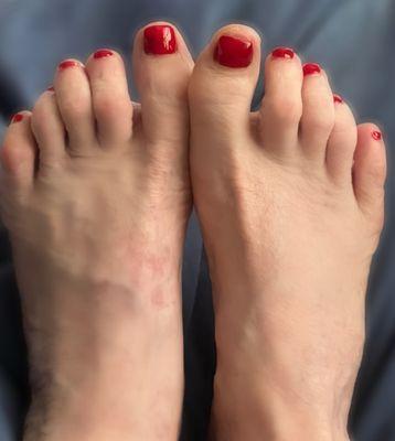 Imperfect feet but the best they can be after pedicure at The C Room.