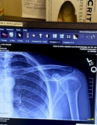 Mountain View Rehabilitation