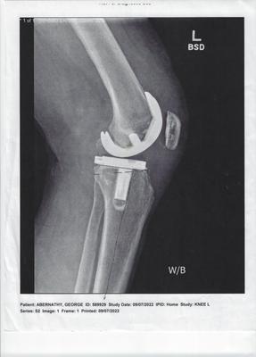 FXRX: Sumit Dewanjee, MD