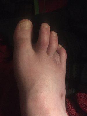 Kitsap Podiatry Foot And Ankle Specialists