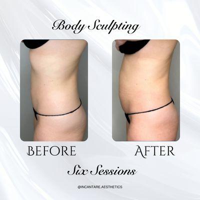 Incantare Aesthetics offers body sculpting treatments that are available in Meridian, located inside Sugar and Blow.
