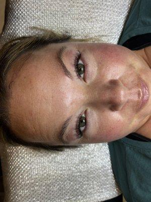 After Classic Full Set