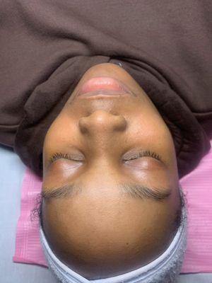 Glo Therapy
