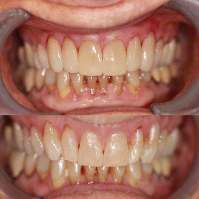 May Y. Huang, DDS - Evergreen Dental Group