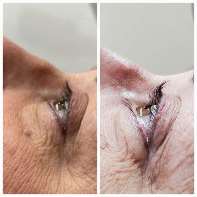 Before and after lash lift