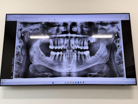 Matthew T Waite, DDS, MS