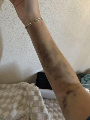 BioLife Plasma Services