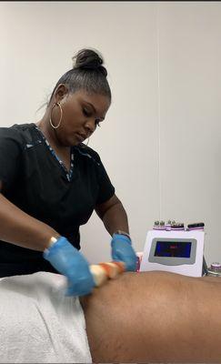 Wood therapy on stomach