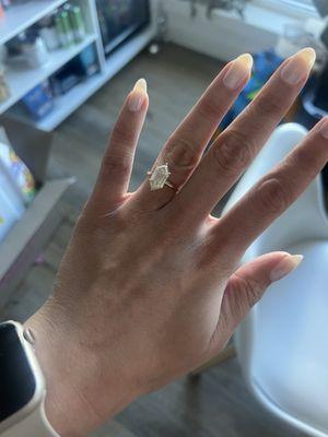 resized ring
